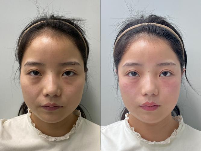 整容项目与个人具体整容经历有何显著差异？